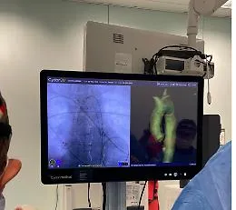 Policlinico di Palermo, eseguiti tre interventi di riparazione di aneurisma dell&rsquo;aorta con l'intelligenza artificiale